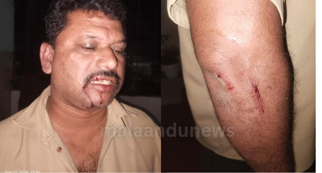 ആലുവയിൽ മദ്യപസംഘം ഓട്ടോ ഡ്രൈവറെ ക്രൂരമായി മർദ്ദിച്ചു.
