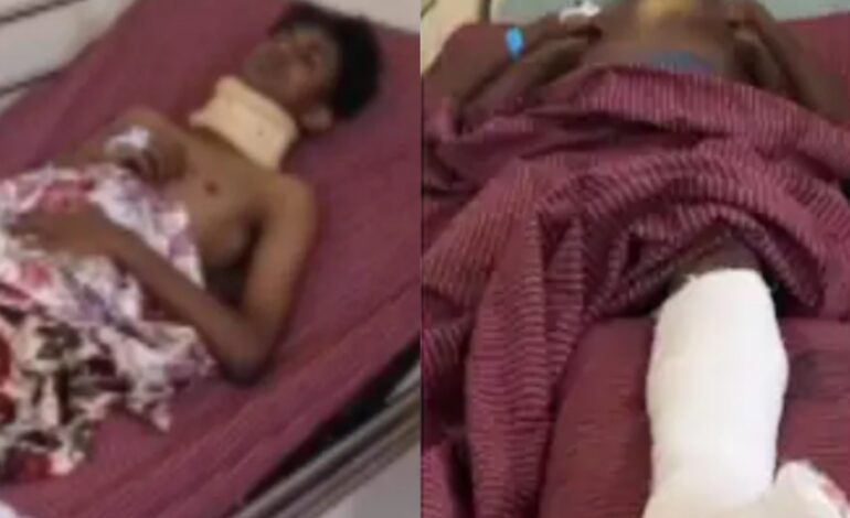 തിരുവനന്തപുരത്ത് പത്താം ക്ലാസ് വിദ്യാര്‍ഥിയെ സീനിയര്‍ വിദ്യാര്‍ഥികള്‍ ക്രൂരമായിമര്‍ദ്ദിച്ചു :നടുവിനും കഴുത്തിനും തലയ്ക്കും മാരക പരുക്ക്