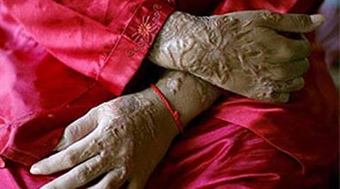 വാലന്റൈൻസ് ദിനത്തിൽ പ്രണയാഭ്യാ‍ർഥന നിരസിച്ചു :യുവതിയെ കുത്തി വീഴ്ത്തി ആസിഡ് ഒഴിച്ച് യുവാവ്