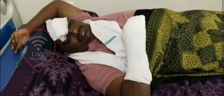 വാഹനത്തിൽ കാട്ടുപന്നിയിടിച്ചു: കോട്ടോപ്പാടംപഞ്ചായത്ത് മെമ്പർക്ക് ഗുരുതര പരുക്ക്