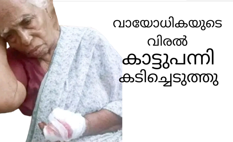 വയോധികയുടെ വിരല്‍കാട്ടുപന്നി കടിച്ചെടുത്തു