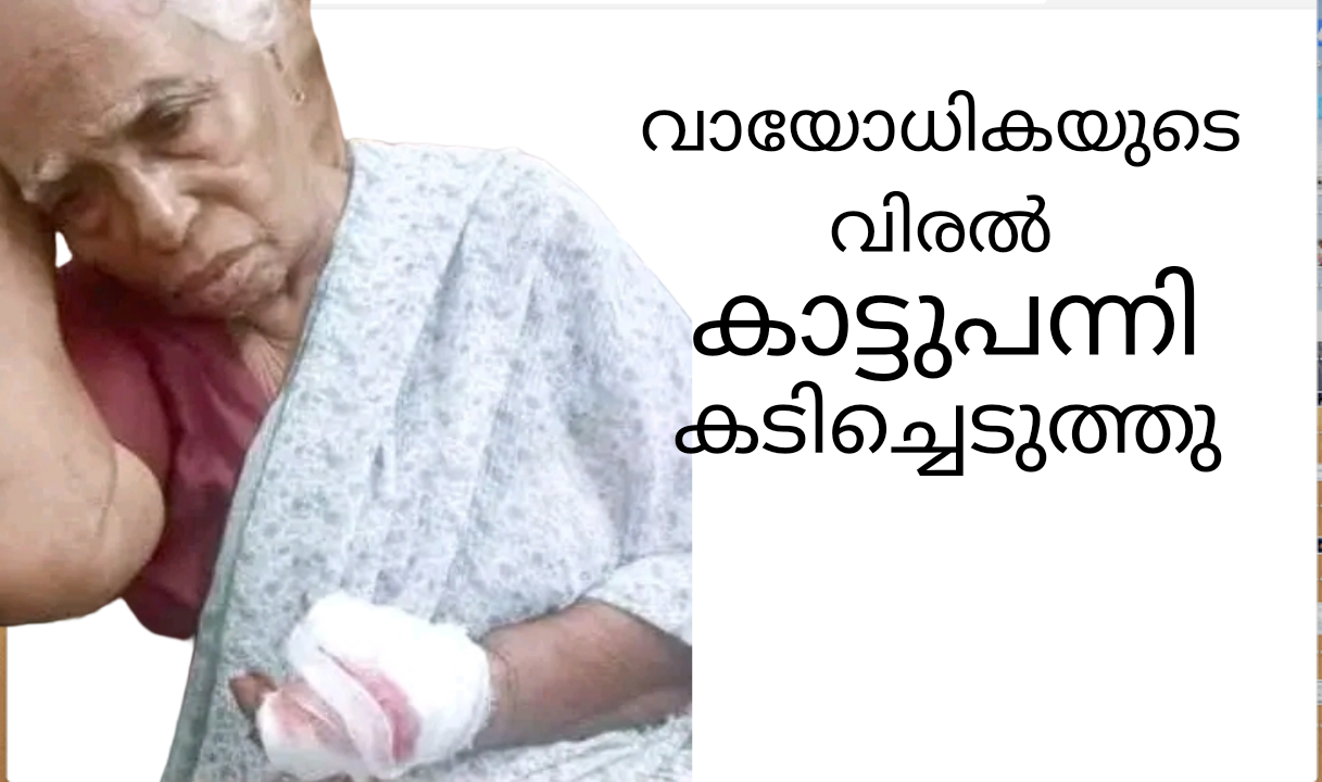 വയോധികയുടെ വിരല്‍കാട്ടുപന്നി കടിച്ചെടുത്തു