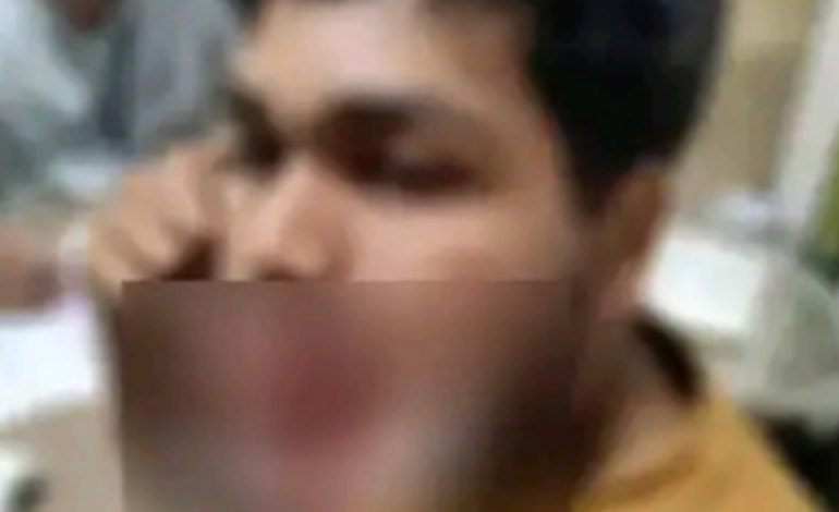 ട്രെയിനിൽ നിന്ന് വലിച്ചെറിഞ്ഞ മദ്യക്കുപ്പി ദേഹത്തുവീണ് കാൽനടക്കാരന് പരുക്ക്