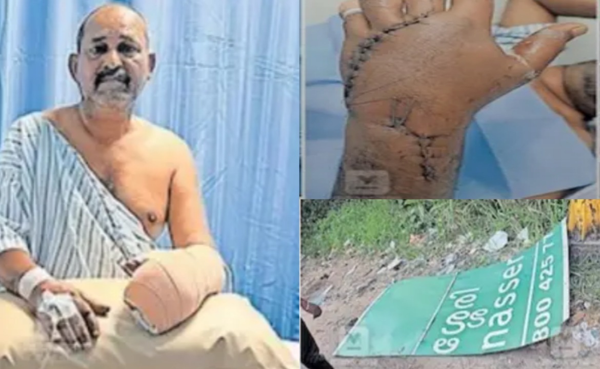 കൊട്ടാരക്കരയിൽ ദിശാസൂചിയിലെ ലോഹപാളി അടർന്നു വീണ് സ്കൂട്ടർ യാത്രികന്റെ കൈ അറ്റുതൂങ്ങി