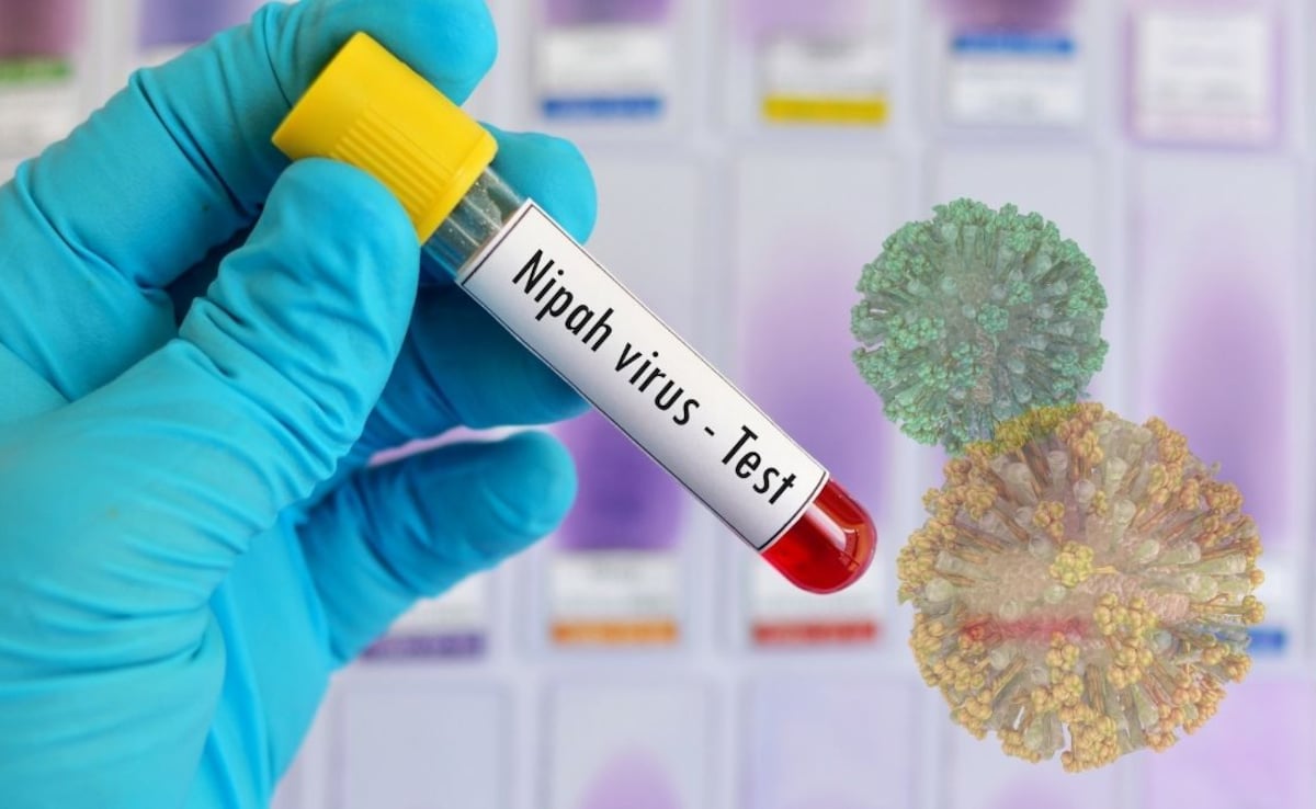 ഇന്ത്യയിലെ നിപ്പ വൈറസ് ഭീഷണി: ജാഗ്രതയുമായി ഓസ്‌ട്രേലിയയും ഇന്തോനേഷ്യയും