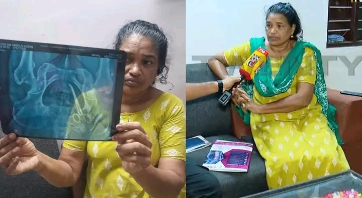 ആലപ്പുഴ മെഡിക്കൽ കോളേജിൽ അഞ്ച് വർഷം മുമ്പ് ശസ്ത്രക്രിയ നടത്തിയ വീട്ടമ്മയുടെ വയറിനുള്ളിൽ കത്രിക കണ്ടെത്തി