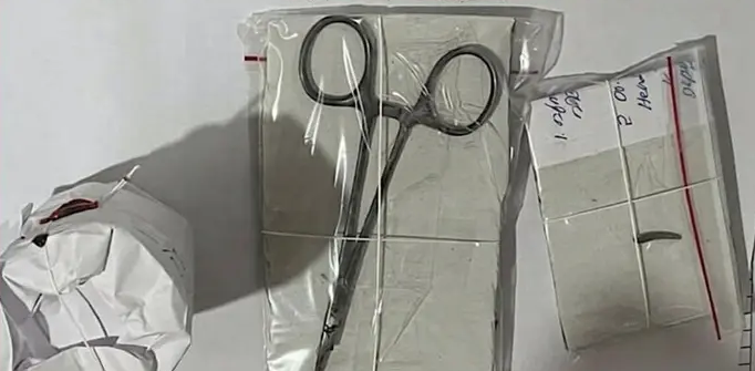 ശസ്ത്രക്രിയ പൂർത്തിയായി; വയറ്റിൽ കുടുങ്ങിയിരുന്ന കത്രിക പുറത്തെടുത്തു