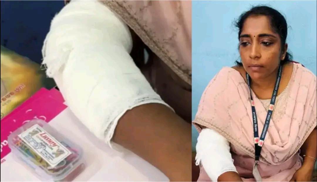 മുക്കം നഗരസഭയിൽ ജീവനക്കാരിയെ കടിച്ച് ആക്രമണം; മൂന്ന് പേർക്ക് പരിക്ക്